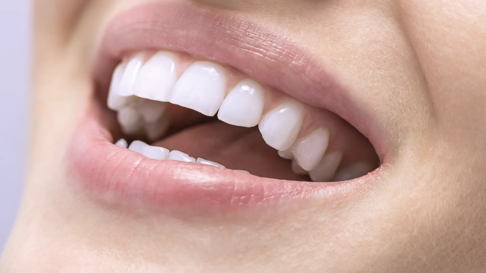 Composite Bonding